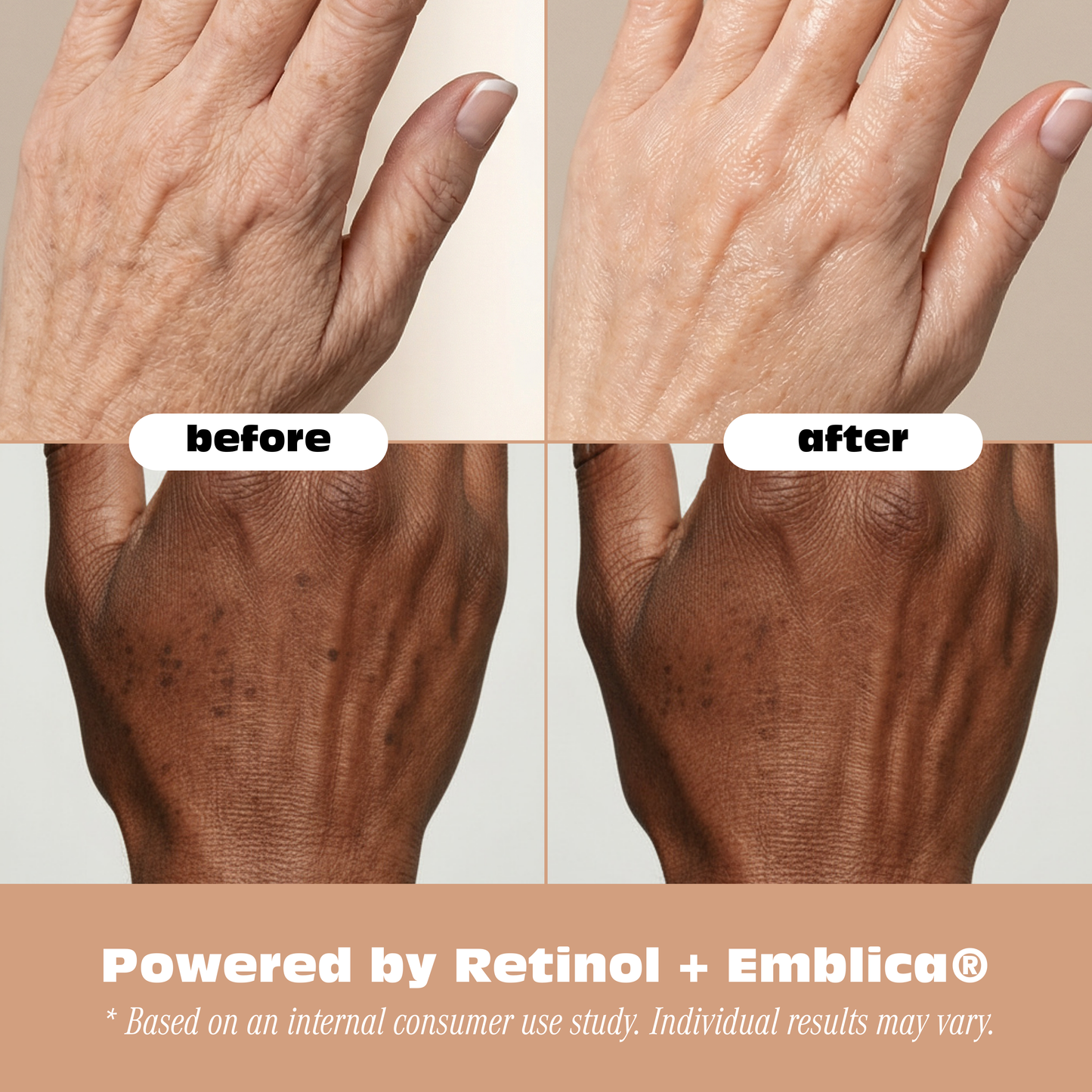 Retinol Anti-Aging Hand Cream