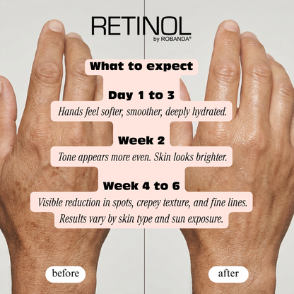 Retinol Anti-Aging Hand Cream