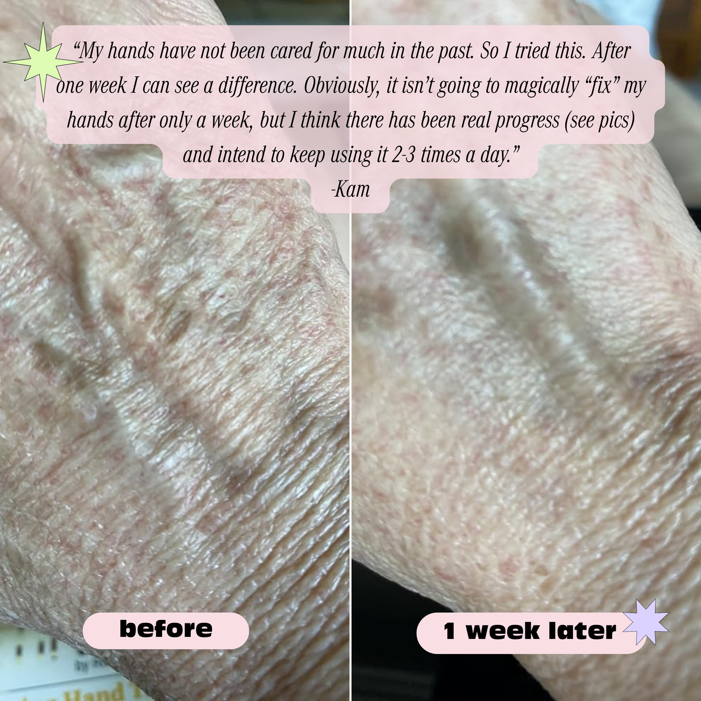 Retinol Anti-Aging Hand Cream